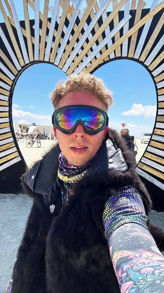 Breaking: Burning Man 2023 DJ James Patrick Suffers Life-Altering Accident, Faces $50K Medical Debt