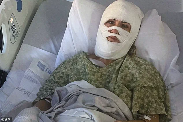 Woman Suffers Acid Attack in Savannah Park