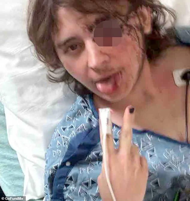 ICE Protest in Santa Ana Turns Violent, Leaving Student's Life in Ruins
