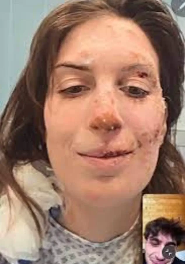 Eleonora Palmieri's Battle: From Nightclub Fire to the Long Road of Healing