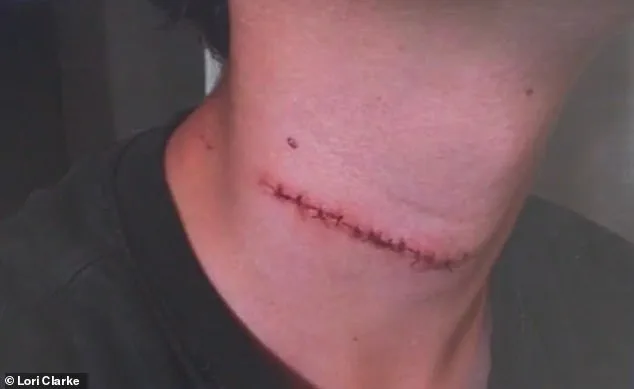 Millimeter from Death: 13-Year-Old Survives Knife Attack on Daytona Beach Boardwalk