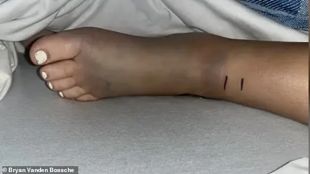 14-Year-Old California Girl Survives Rattlesnake Bite During Mountain Bike Adventure