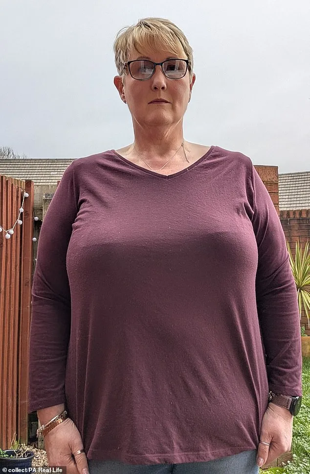 Devon woman seeks NHS surgery after severe breast hypertrophy ruins her life.